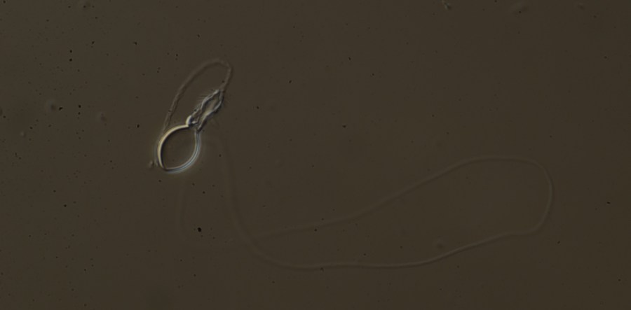 Stinging Cells from the&nbsp;Summer!